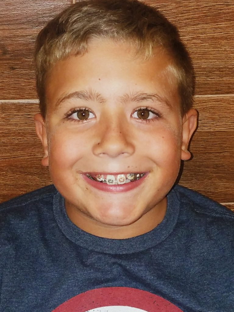 orthodontics in wheat ridge