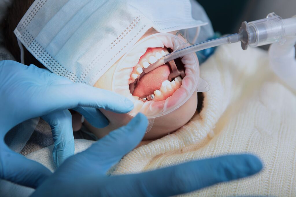 Crowns for Baby Teeth: Protecting Your Child's Smile