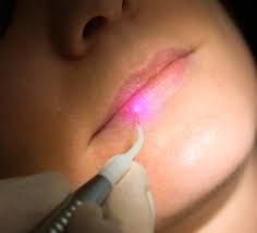 laser dentistry in wheat ridge