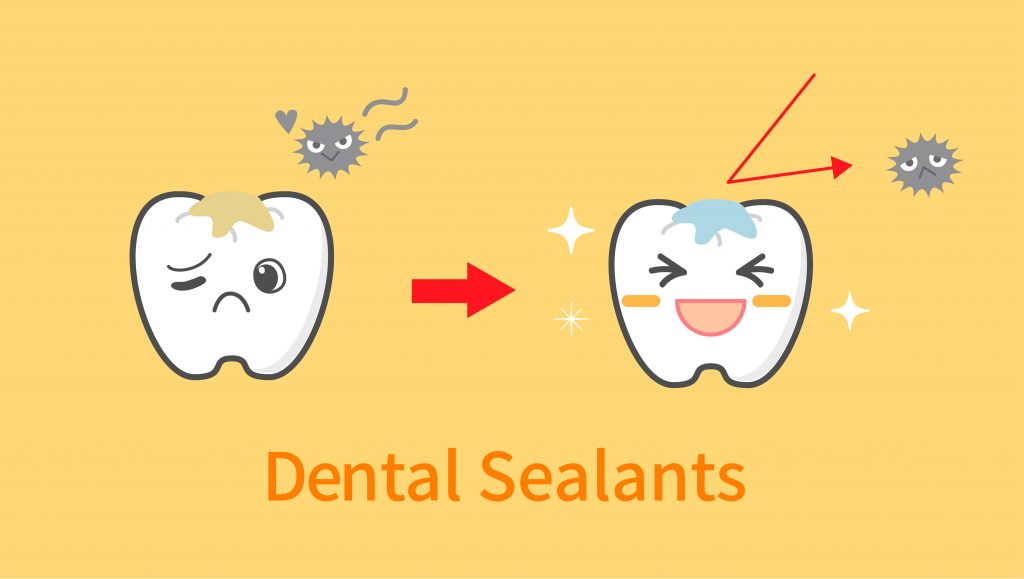 what are dental sealants